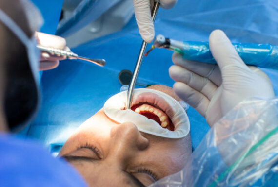 Chirurgische Parodontitis Behandlung
